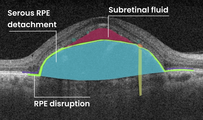 AI Ophthalmology and Optometry | Altris AI