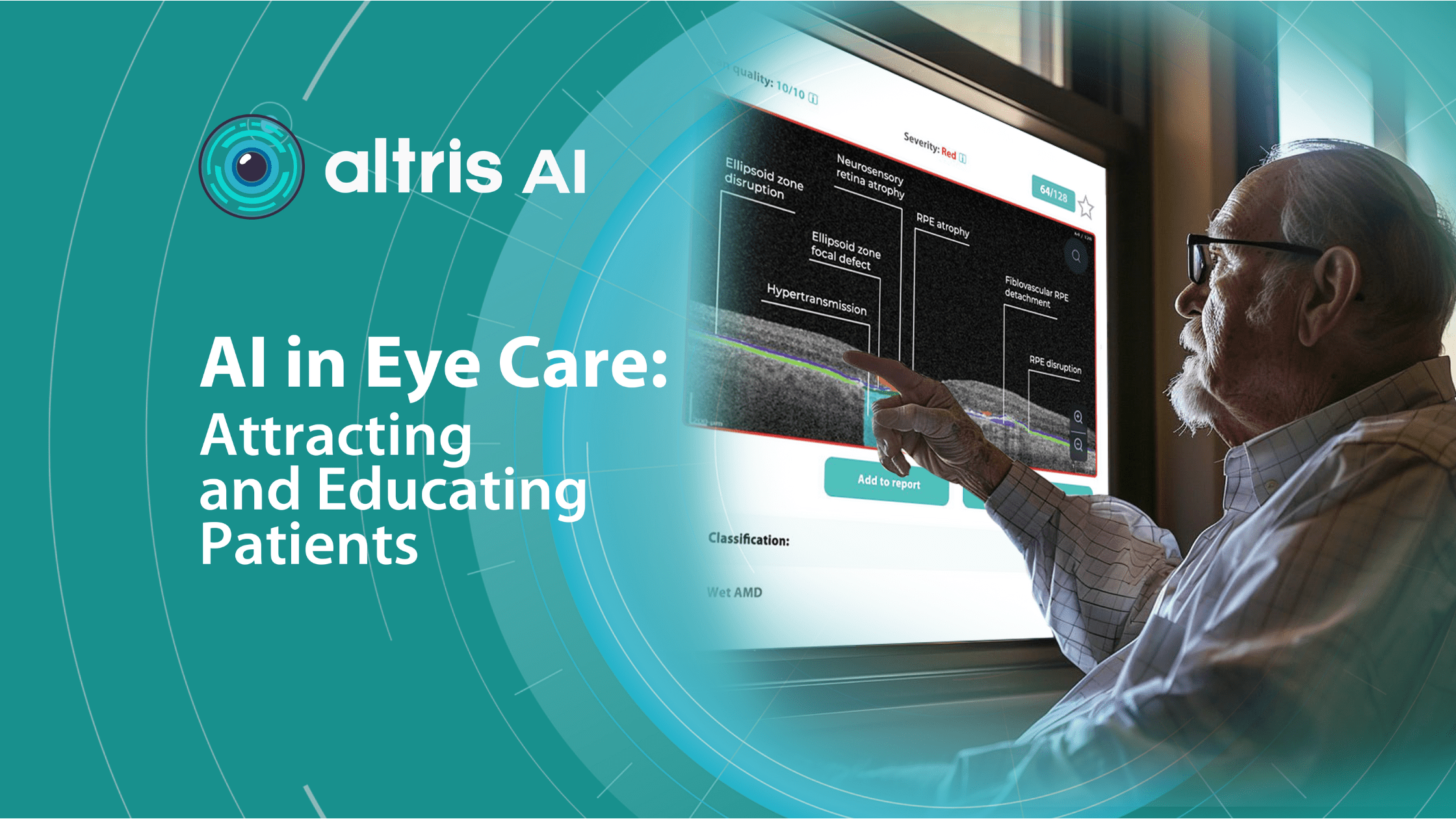 optometry patient education