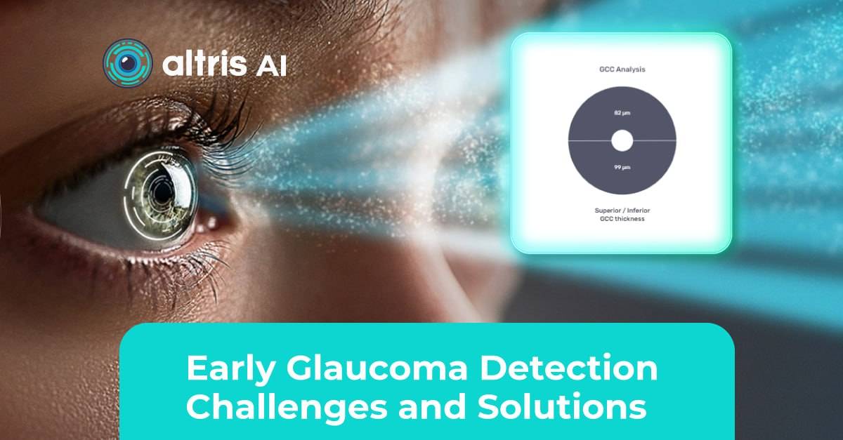 early glaucoma detection