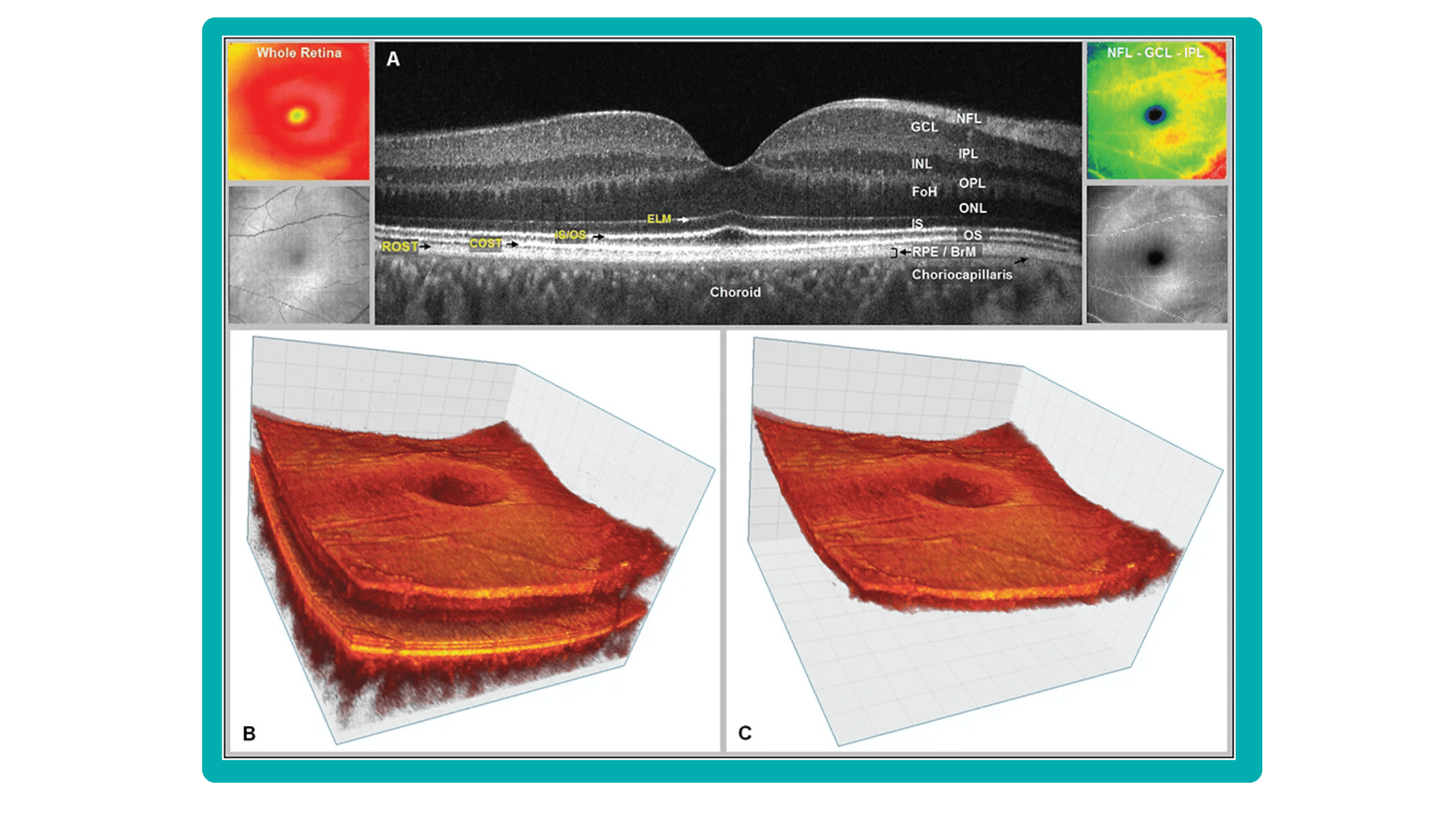 3d visualization of OCT scan results in OCT report