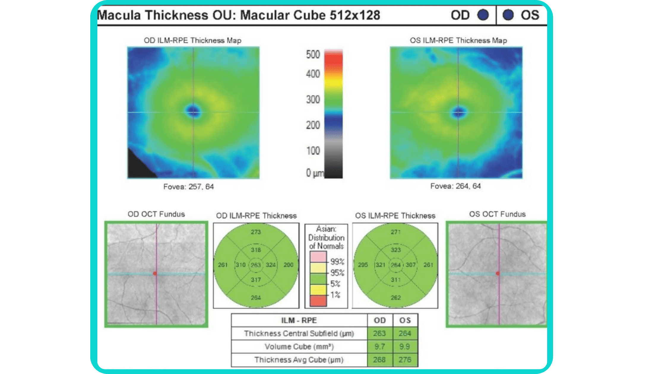 An example of a common OCT report