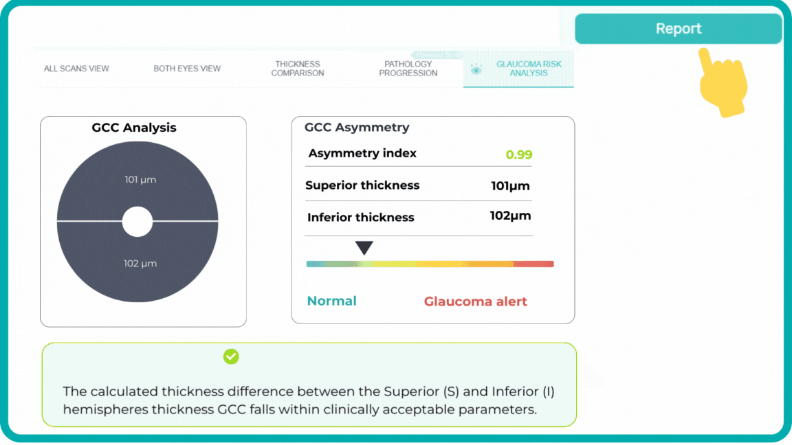 Customizable OCT reports