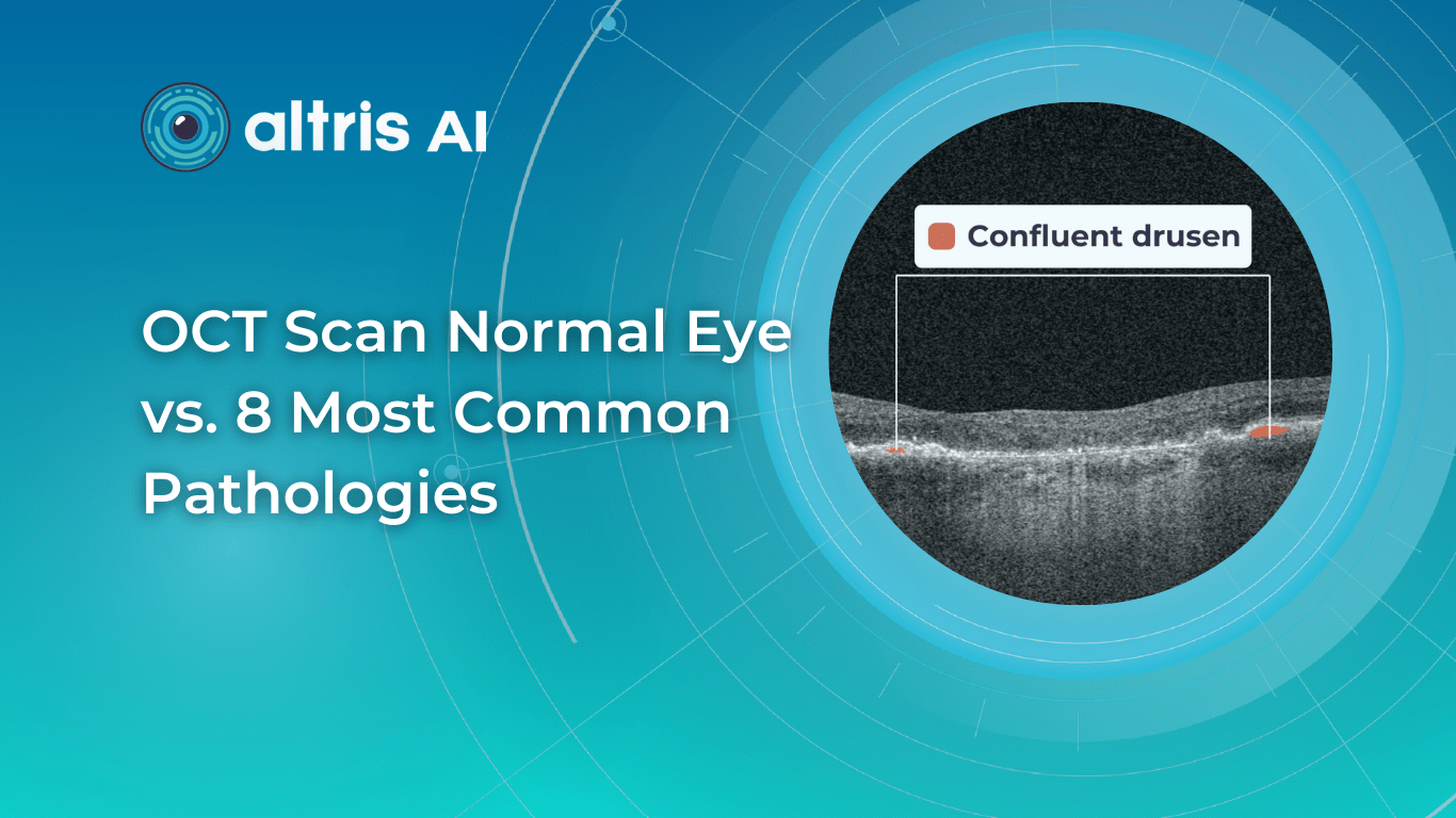 normal abnormal oct scan