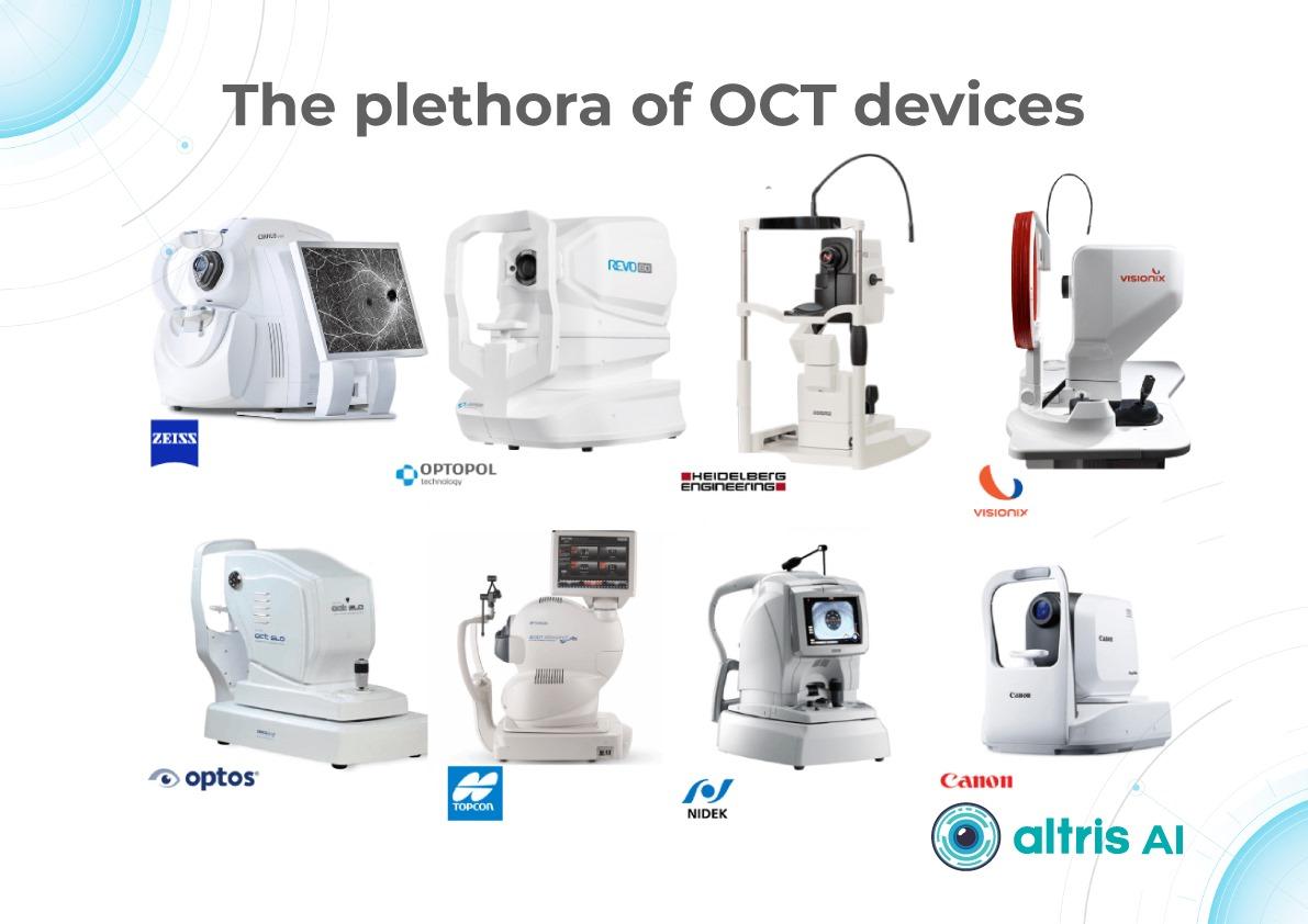 OCT devices used to monitor AMD progression