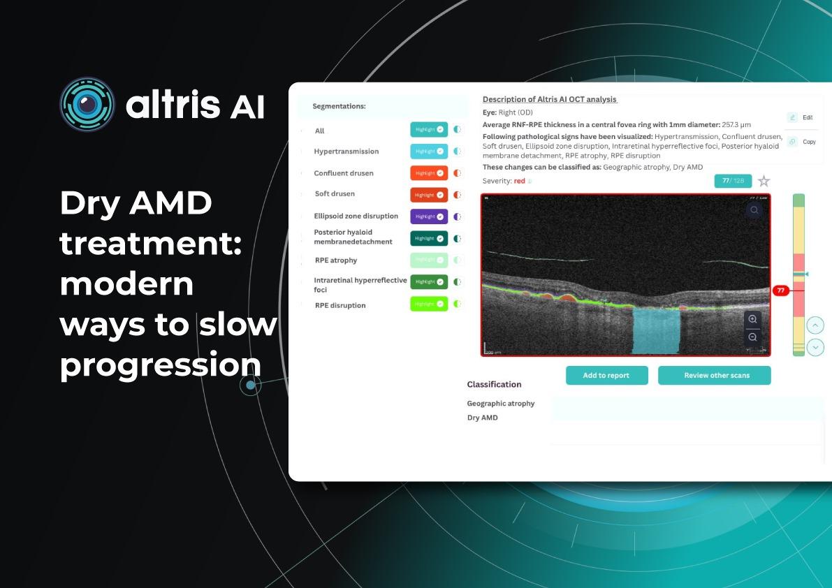 Dry Macular Degeneration Treatment Breakthroughs