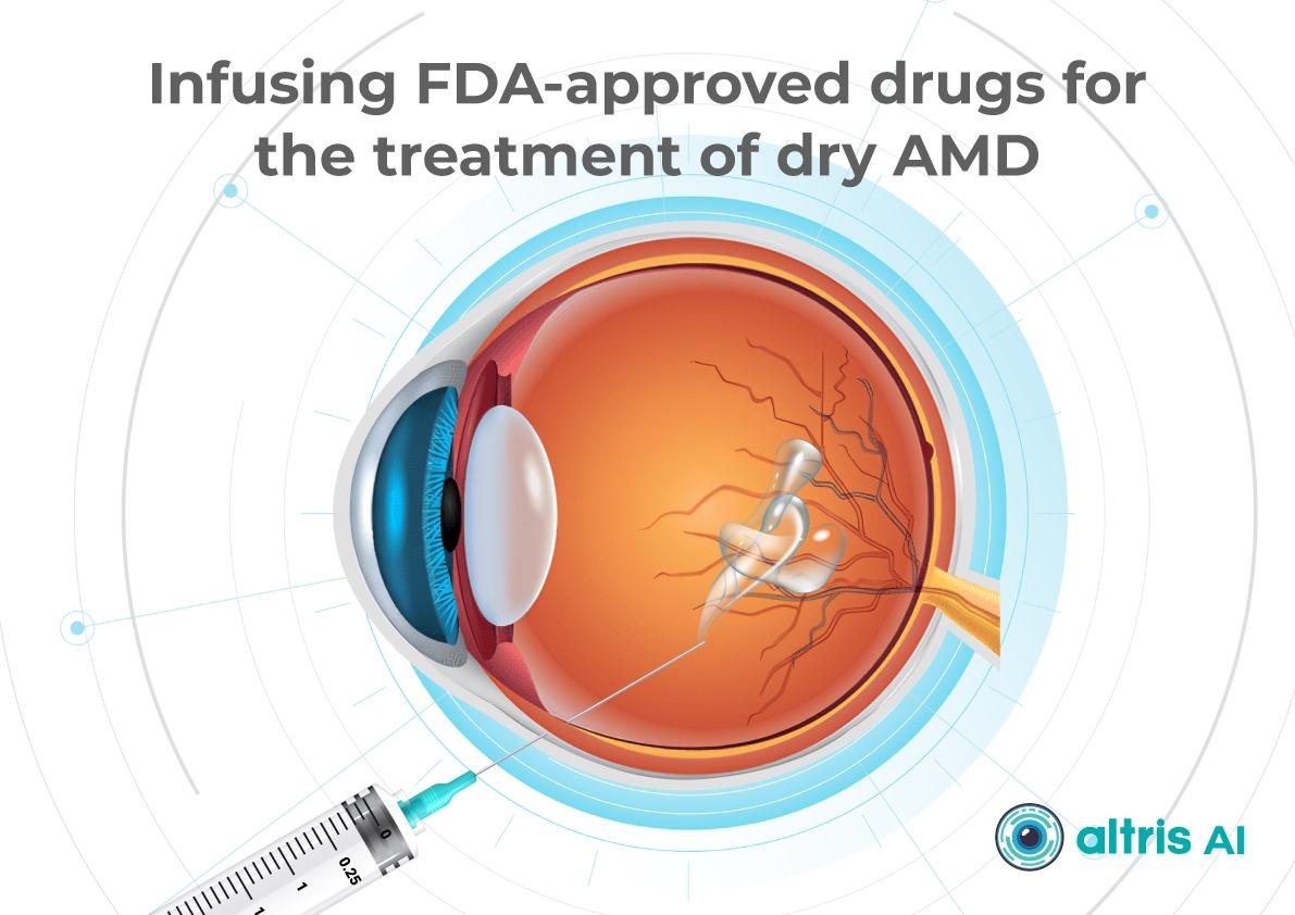Dry macular degeneration injections