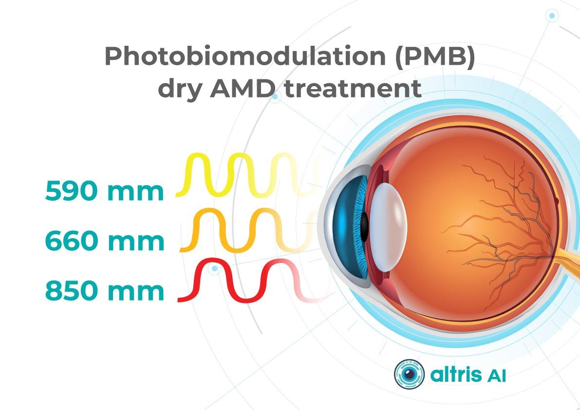 Dry Macular Degeneration Treatment Breakthroughs: Multiwavelength photobiomodulation 