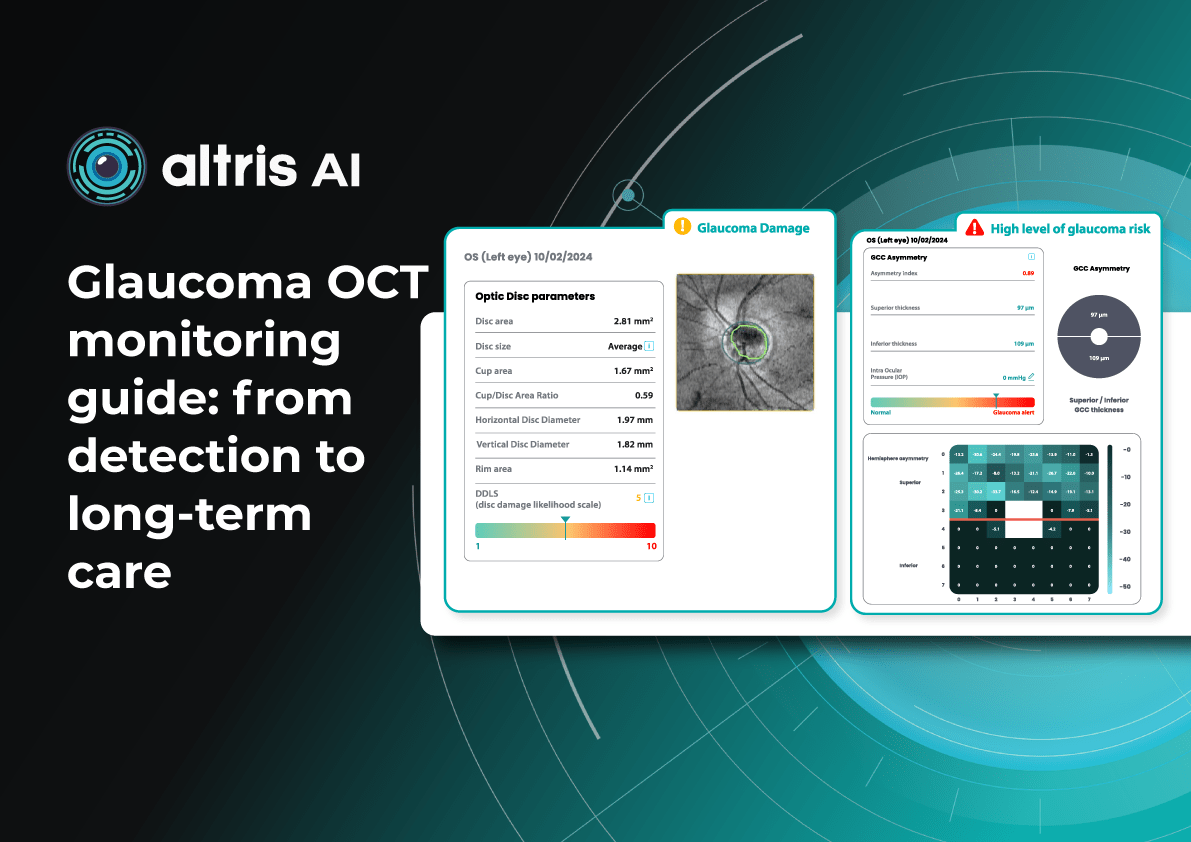 Glaucoma OCT monitoring guide