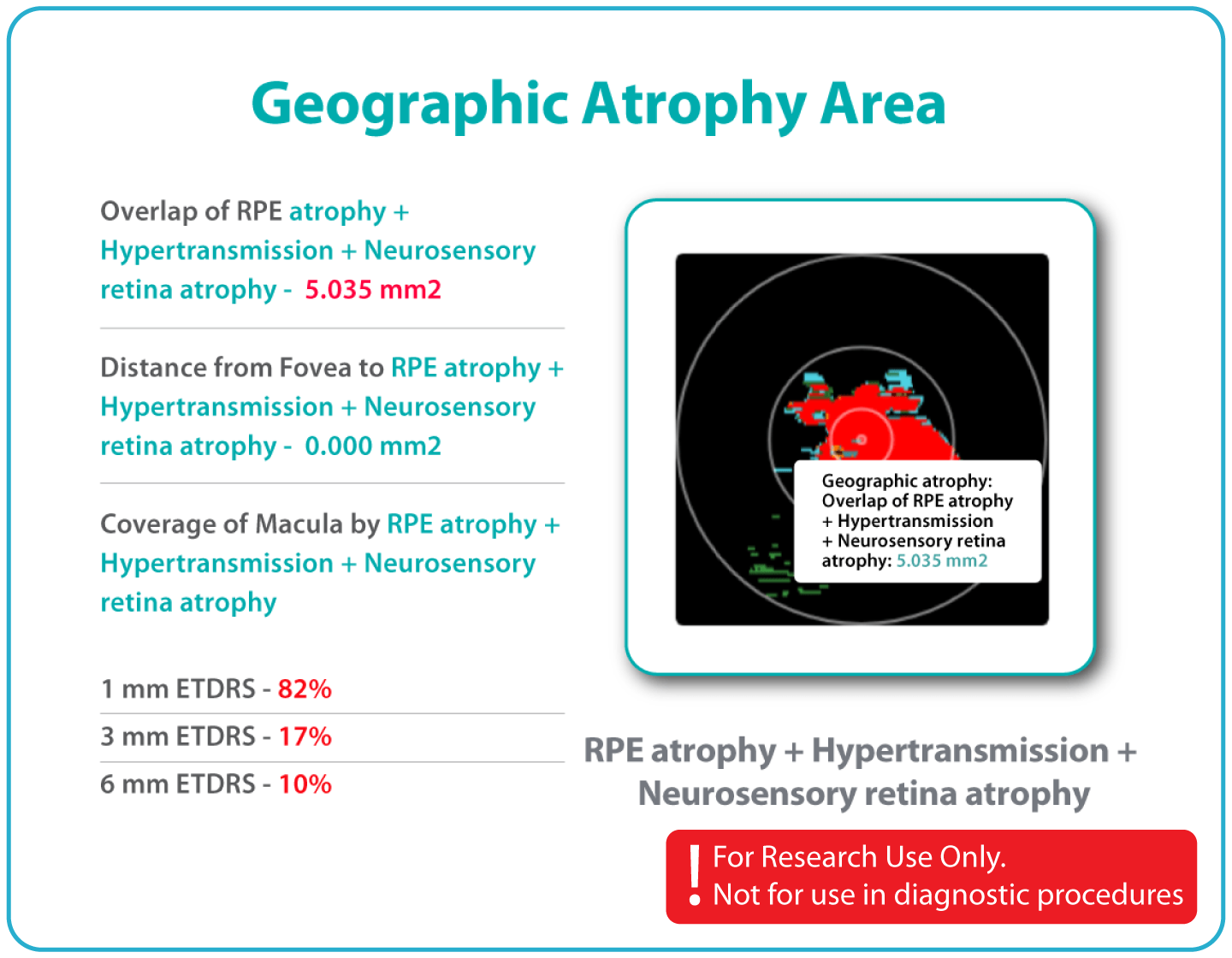 AI Ophthalmology and Optometry | Altris AI