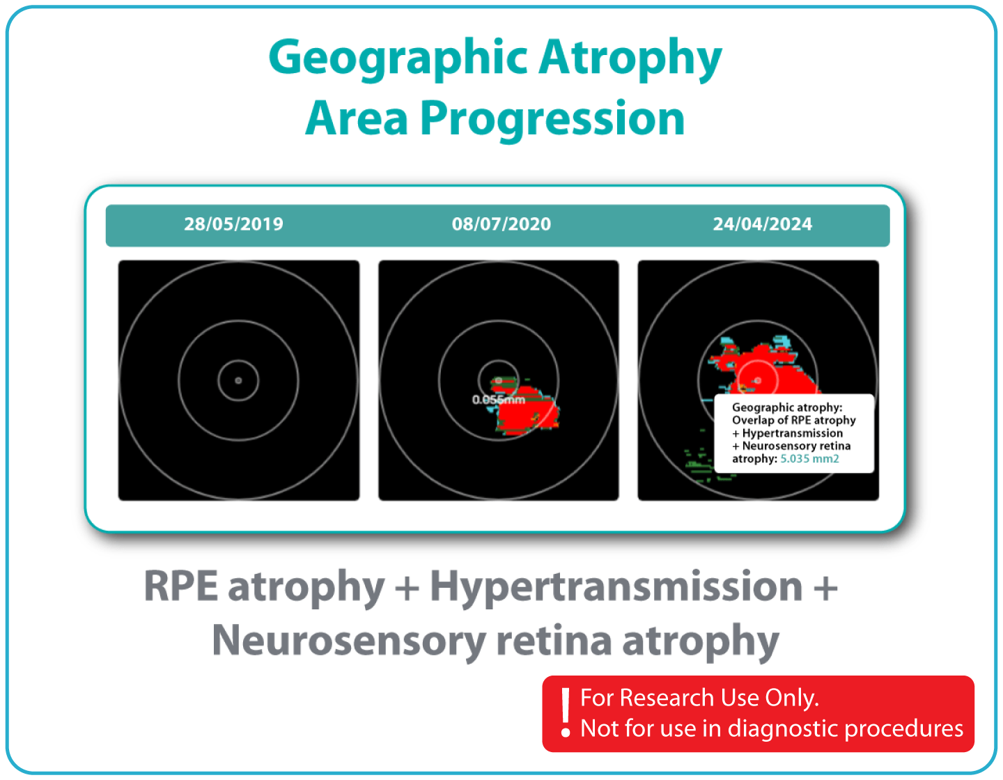 AI Ophthalmology and Optometry | Altris AI