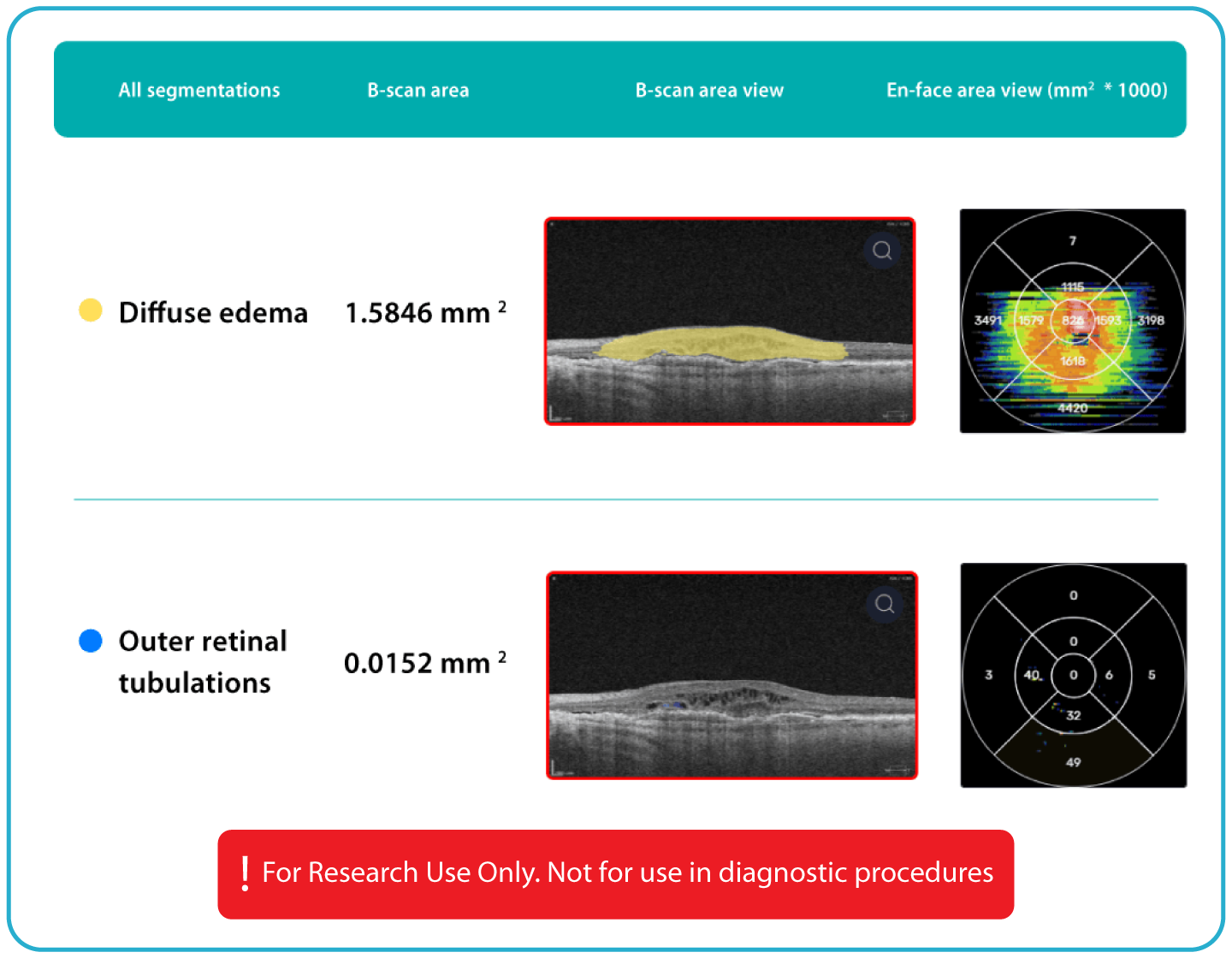AI Ophthalmology and Optometry | Altris AI